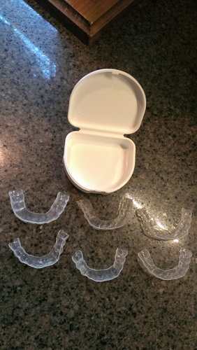 Professional Custom Teeth Whitening Tray Kit. Dental Lab Direct, Custom Made Teeth Whitening Tray, U.S.A Made Bleaching Trays with 38% High Intensity Gel Fast Results Custom Upper and Lower Trays customer photo 2