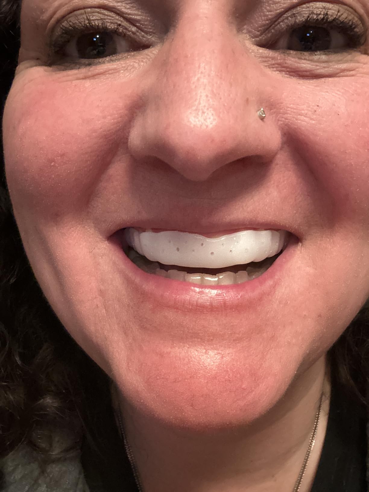 SOVA Aero Night Guard with Case - 1.6mm Thin - Custom-Molded Fit - Protects Against Nighttime Teeth Grinding & Clenching - Odor & Taste Free - Remoldable Up to 20 Times - Non Toxic customer photo 1