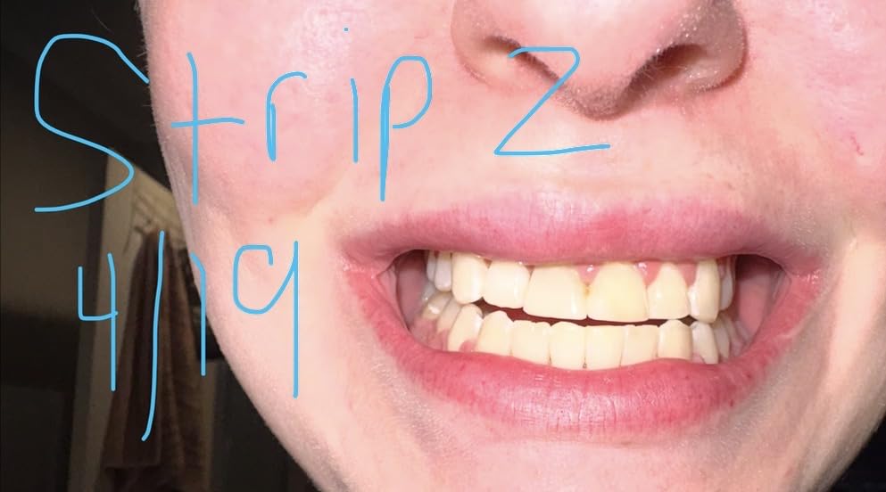 Crest Teeth Whitening Strips, Crest 3D Whitestrips Vivid Plus, Enamel Safe Teeth Whitening Kit, 12 Treatments (24 Strips), Visibly Whitens in Days, 8 Levels Whiter customer photo 2