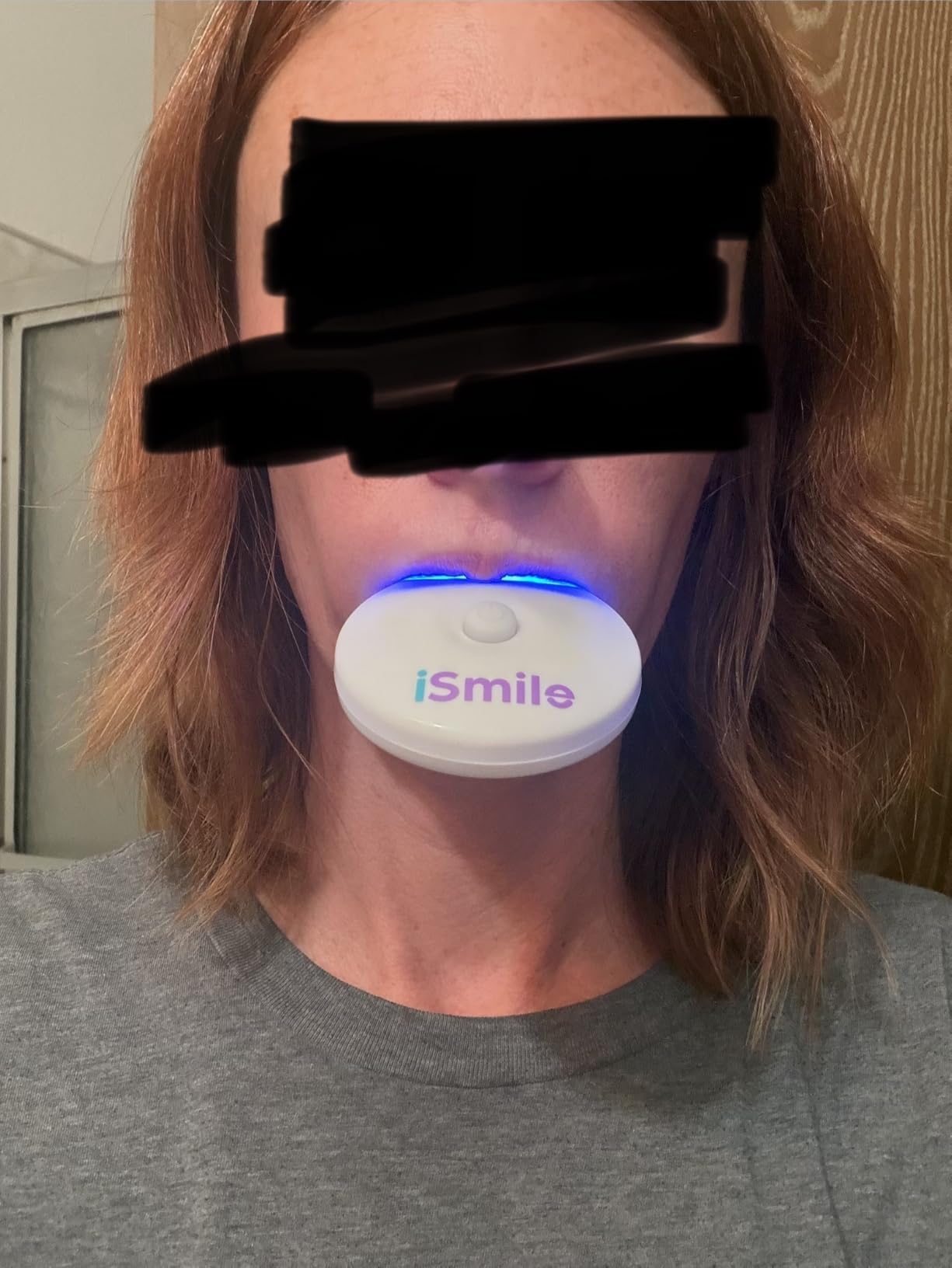 iSmile Teeth Whitening Kit - LED Light, 35% Carbamide Peroxide, (3) 3ml Gel Syringes, (1) Remineralization Gel, and Tray. customer photo 1