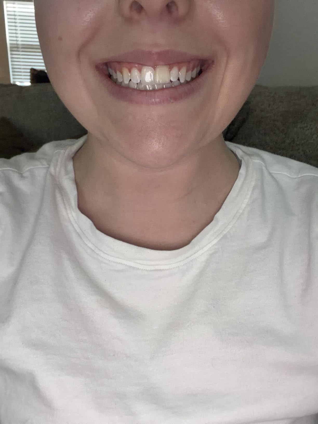 Zimba Coconut Flavored Teeth Whitening Strips | Vegan, Enamel Safe Hydrogen Peroxide Teeth Whitener for Coffee, Wine, Tobacco, and Other Stains | 14 Day Treatment | Coconut customer photo 1