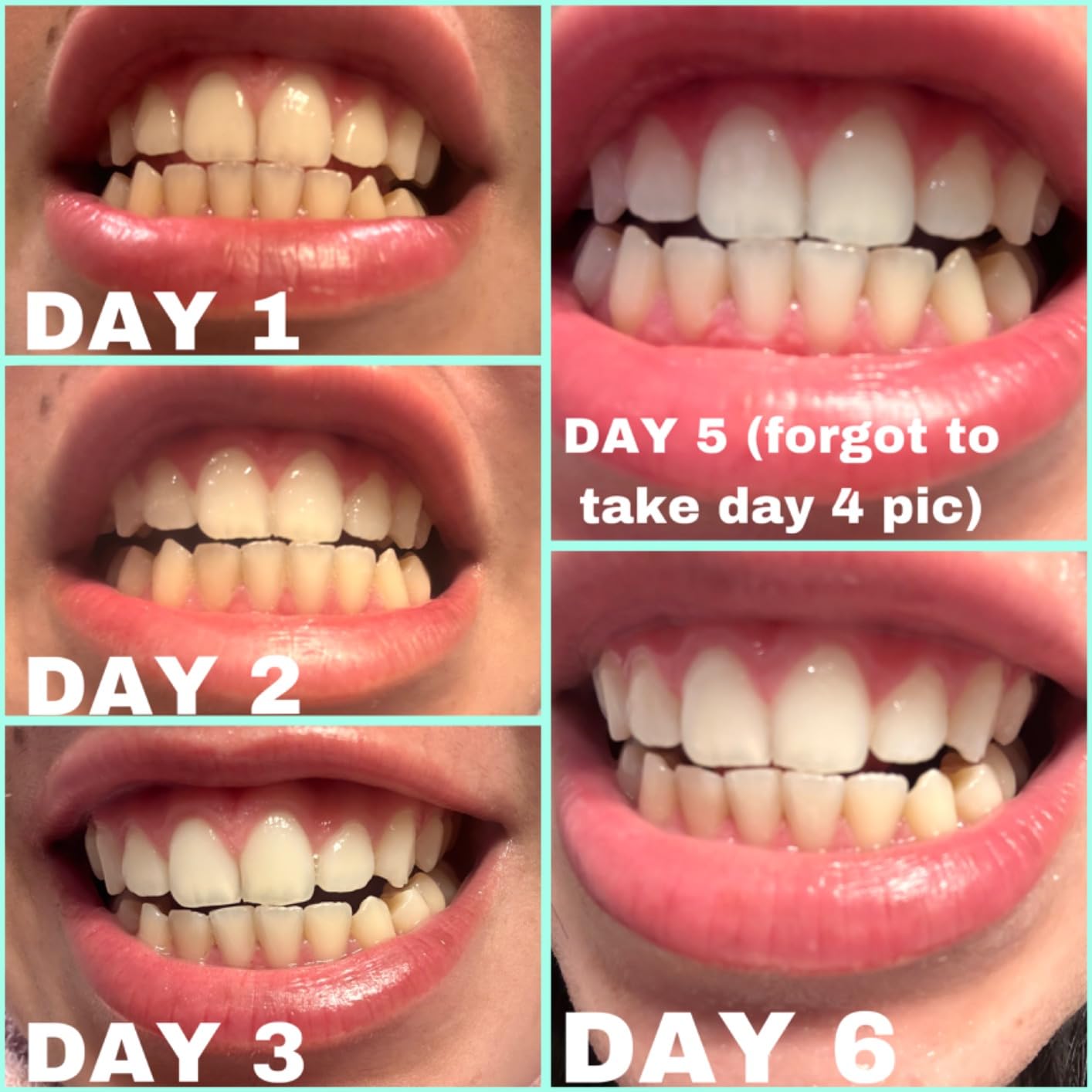 Zimba Coconut Flavored Teeth Whitening Strips | Vegan, Enamel Safe Hydrogen Peroxide Teeth Whitener for Coffee, Wine, Tobacco, and Other Stains | 14 Day Treatment | Coconut customer photo 2