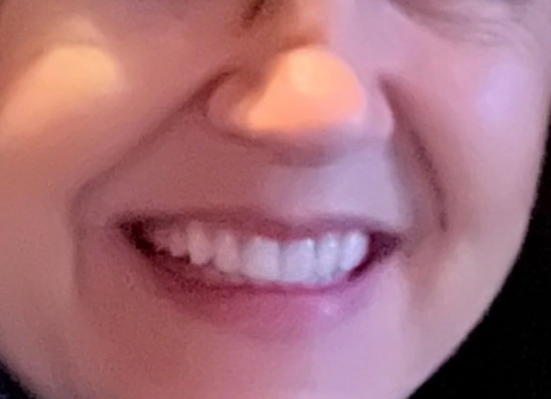 Lumineux Teeth Whitening Strips, Peroxide Free, 9 Treatments (1 Month) customer photo 2