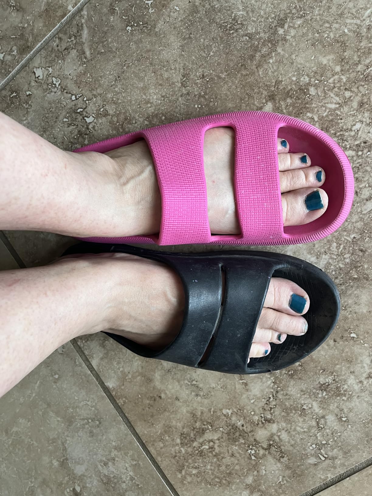shevalues Orthopedic Slide Sandals for Women Arch Support Plantar Fasciitis customer photo 1