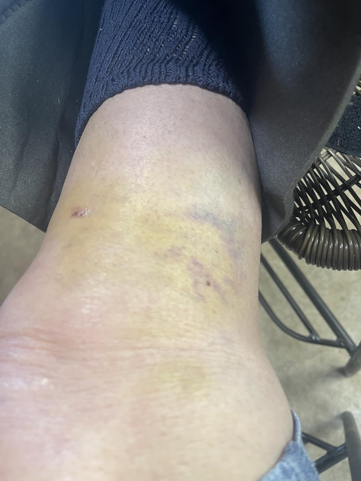 All Terrain Knee Scooter for Adults, Blue customer photo 2