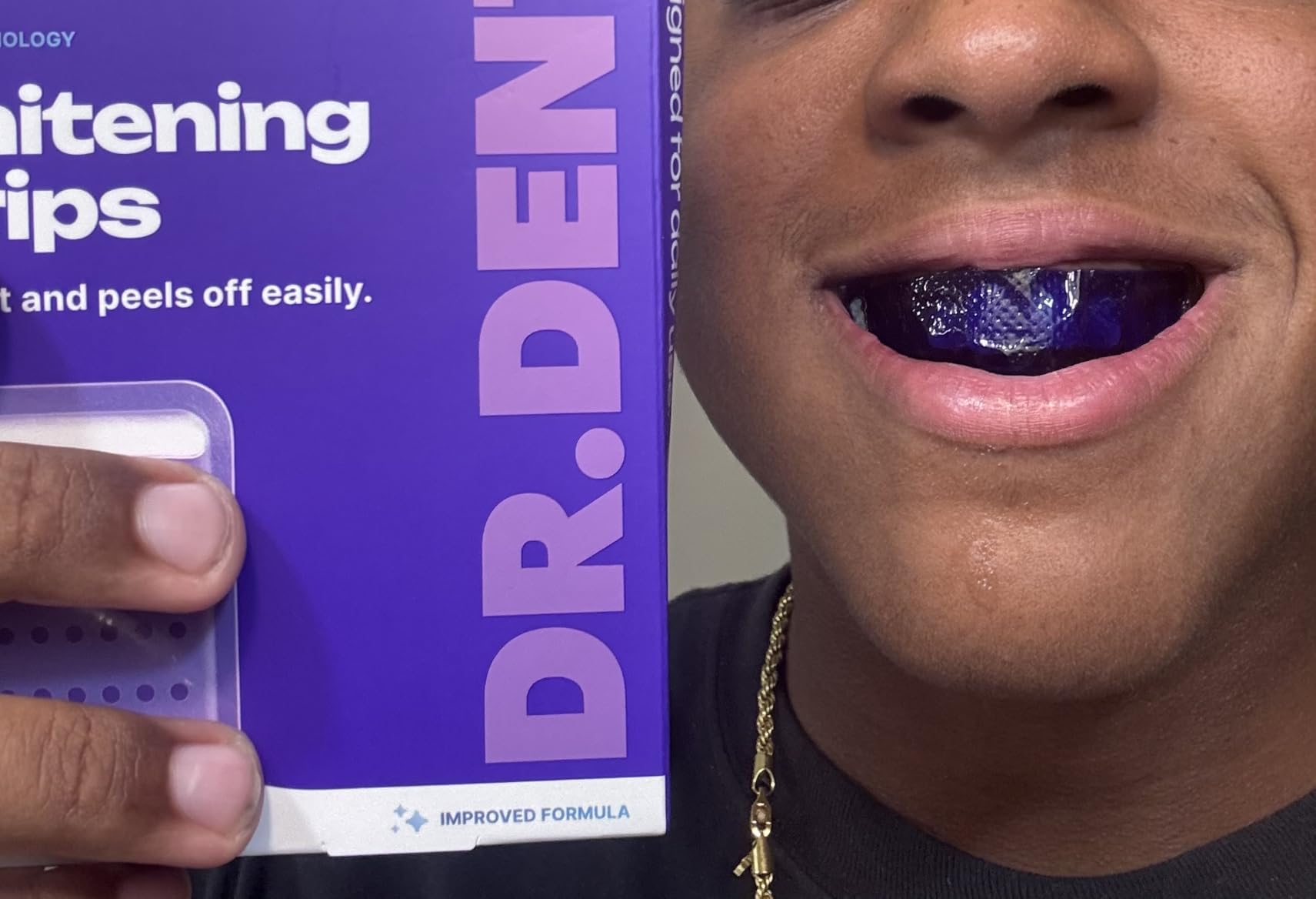 DRDENT Purple Teeth Whitening Strips - 42 Strips (21 Treatments) - Peroxide Free Pap Whitening - Color Correcting Purple customer photo 2