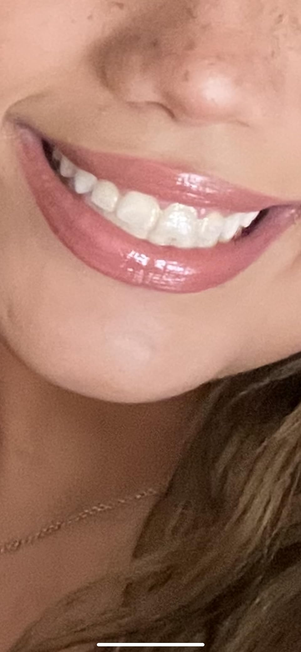 Purple Teeth Whitening Strips - 28 Teeth Whitener Strips (14 Uses) | Purple Color-Correcting Gel Technology | Teeth Whitening Kit for Sensitive Teeth | Enamel Safe, Peroxide-Free for a Brighter Smile customer photo 2